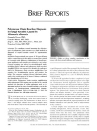 2002 Polymerase Chain Reaction Diagnosis in fungal keratitis caused by Alternaria alternata.pdf.jpg