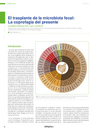 El trasplante de la microbiota fecal.pdf.jpg